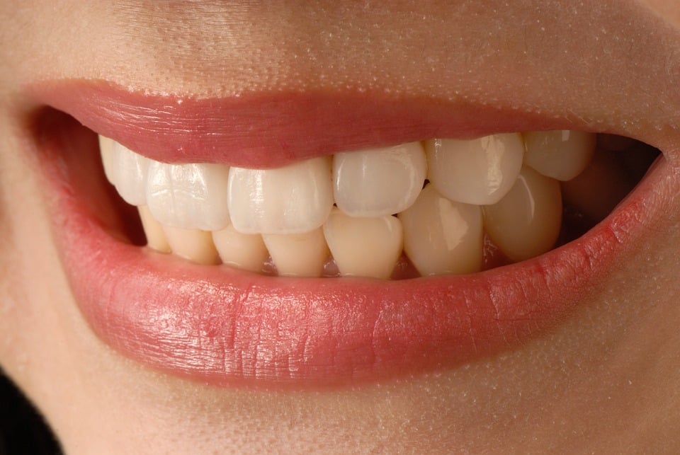 Quelles sont les astuces naturelles pour avoir des dents blanches ?