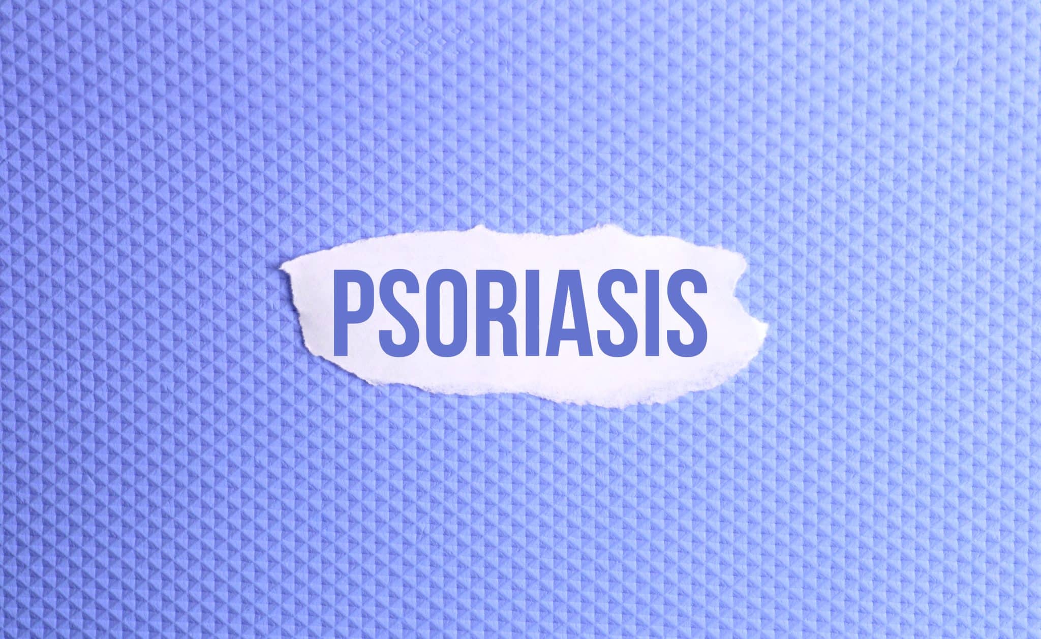 L’huile de massage pour le psoriasis, usages, bienfaits, précautions indispensables